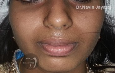 tmj pain centre kerala