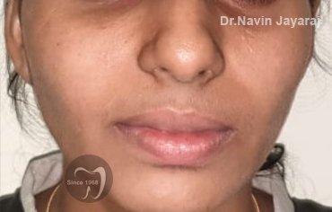 tmj pain centre kerala