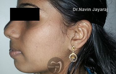 tmj pain centre kerala