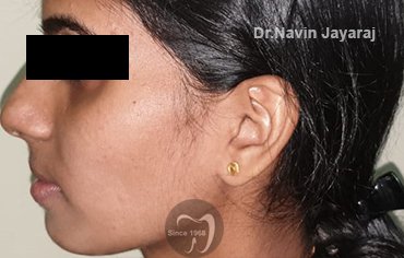 tmj pain centre kerala
