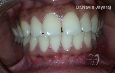 tmj pain centre kerala