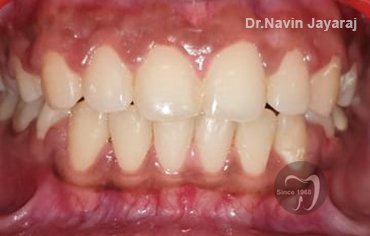 tmj pain centre kerala