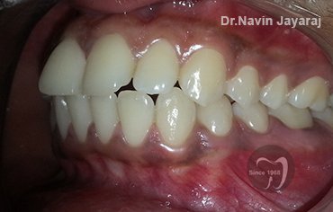 tmj pain centre kerala