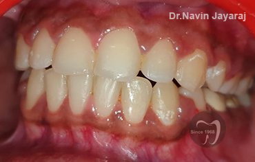 tmj pain centre kerala