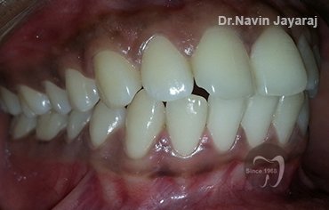 tmj pain centre kerala