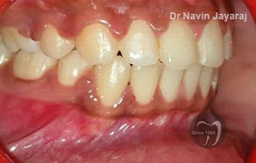 tmj pain centre kerala