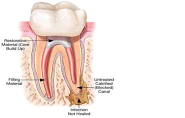 best tmj sleep centers kerala 
