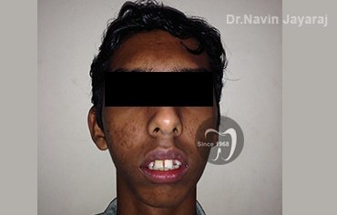 tmj pain centre kerala