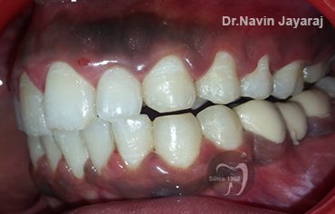 tmj pain centre kerala