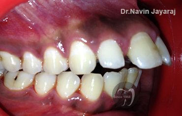 tmj pain centre kerala