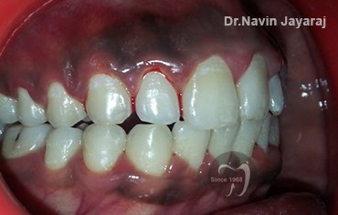 tmj pain centre kerala