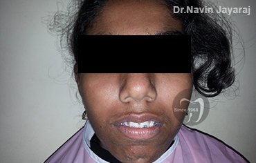 tmj pain centre kerala