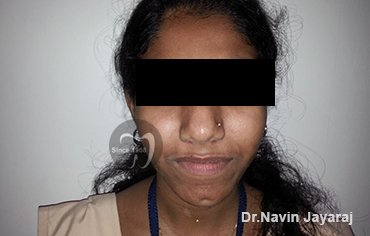 tmj pain centre kerala