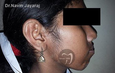 tmj pain centre kerala