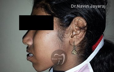 tmj pain centre kerala