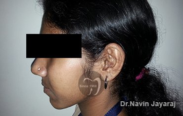 tmj pain centre kerala