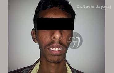 tmj pain centre kerala