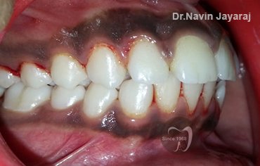 tmj pain centre kerala