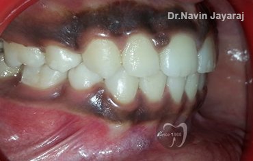 tmj pain centre kerala