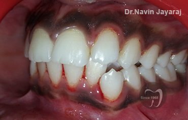 tmj pain centre kerala