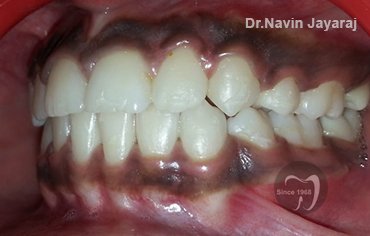 tmj pain centre kerala