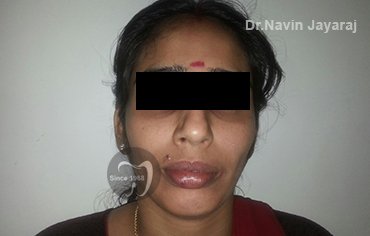 tmj pain centre kerala