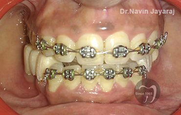 tmj pain centre kerala