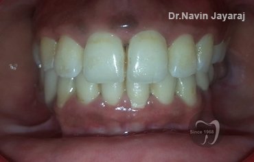 tmj pain centre kerala