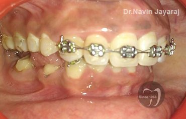 tmj pain centre kerala