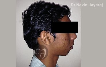 tmj pain centre kerala