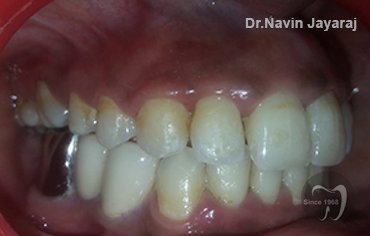 tmj pain centre kerala