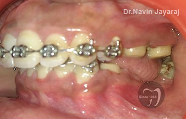 tmj pain centre kerala