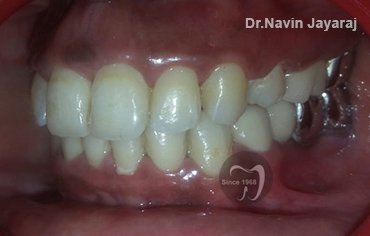 tmj pain centre kerala