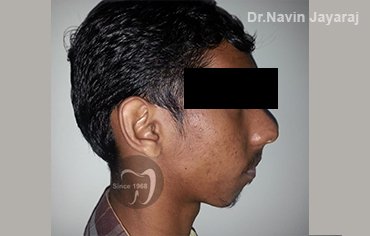 tmj pain centre kerala