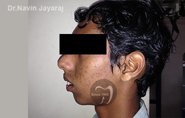 tmj pain centre kerala