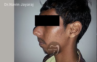 tmj pain centre kerala