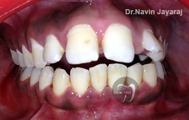 tmj pain centre kerala