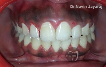 tmj pain centre kerala