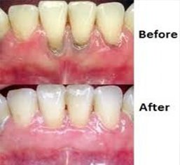 tmj disorder treatments kerala