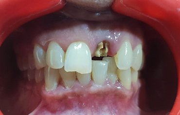 tmj pain centre kerala