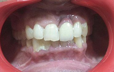 tmj pain centre kerala