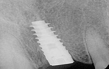 tmj pain centre kerala