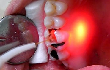 tmj sleep center south india