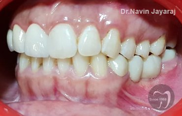 tmj pain centre kerala