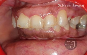 tmj pain centre kerala