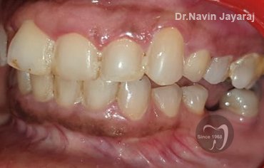 tmj pain centre kerala