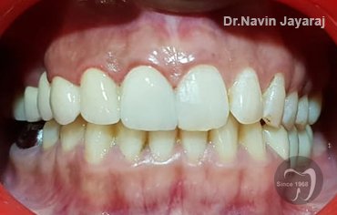 tmj pain centre kerala