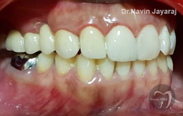 tmj pain centre kerala