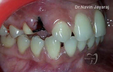 tmj pain centre kerala