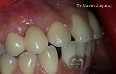 tmj pain centre kerala